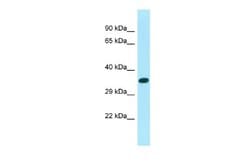 XKR6 Rabbit anti-Human, Polyclonal, Novus Biologicals 0.1 mL | Buy Online | Novus Biologicals | Fisher Scientific